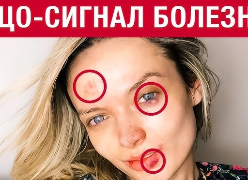 Ваше лицо КРИЧИТ вам о БОЛЕЗНЯХ! 5 болезней, которые ВИДНО на лице!