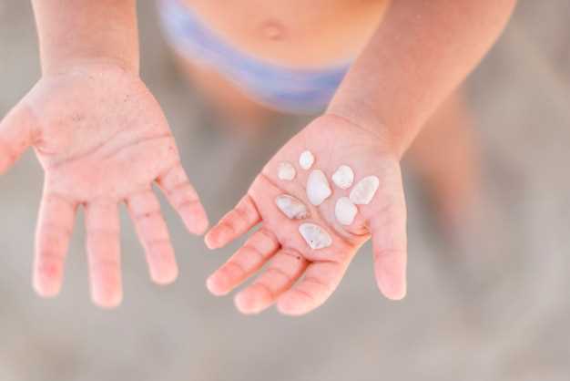 Таблетки от аллергии на солнце как выбрать и применять