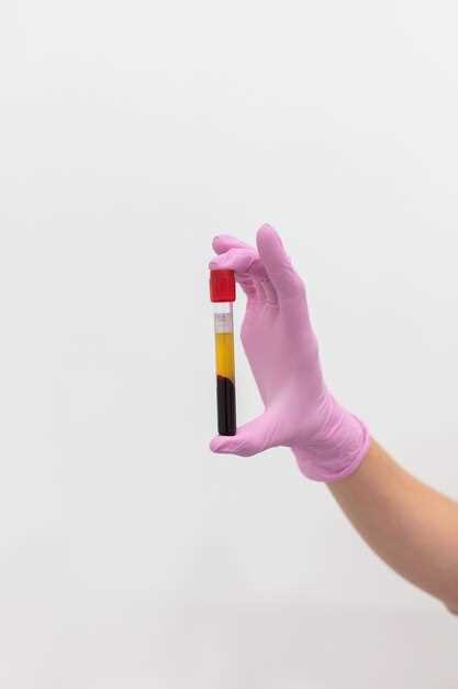 Как подготовиться к анализу крови на уровень Алп: советы и рекомендации