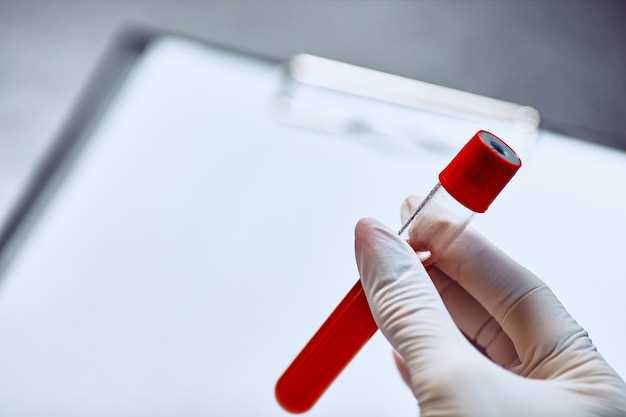 Анализ крови на биохимию: расшифровка результата