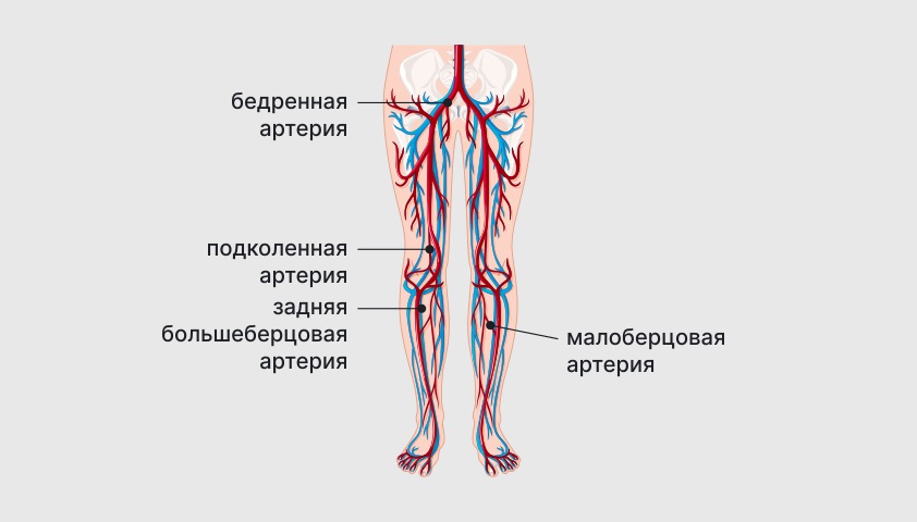 Атеросклероз сосудов нижних конечностей — что это, симптомы и лечение