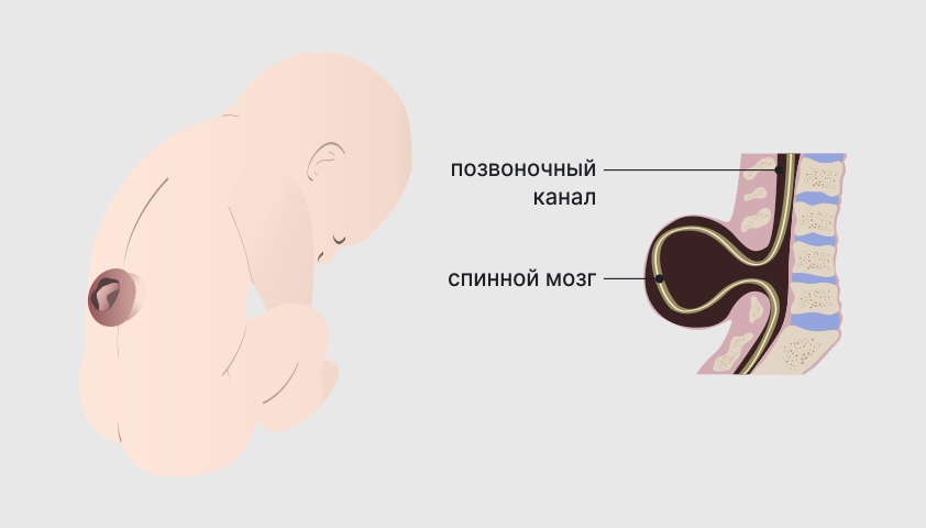 9 недель беременности — что происходит, развитие плода