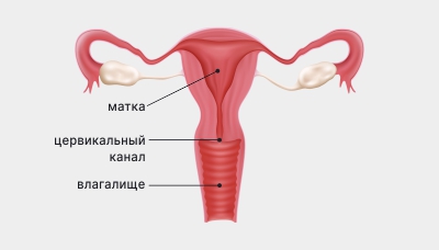 Полип цервикального канала (полип шейки матки) — симптомы и лечение