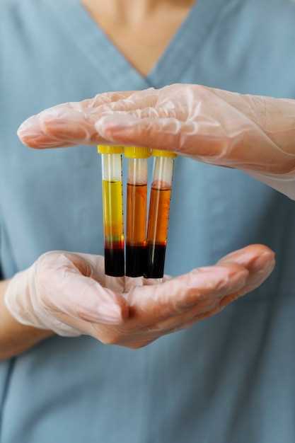 Причины повышения мочевины в крови у мужчин