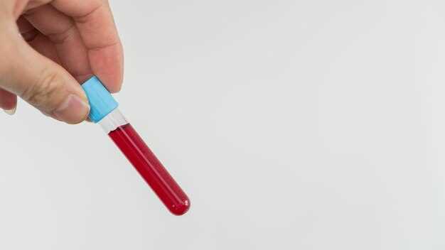 Риски при избытке