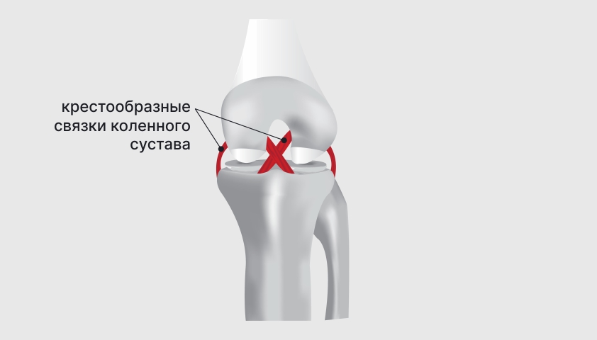 Боль в коленях у женщин и мужчин - причины и лечение