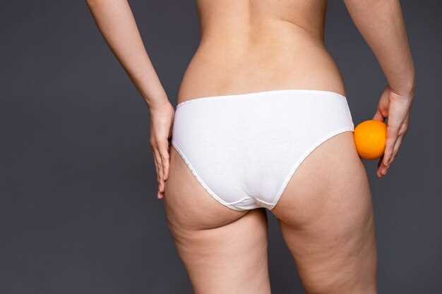 Способы борьбы с целлюлитом на бедрах и ягодицах