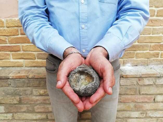 Методы диагностики и выявления факторов, способствующих каменистому стулу