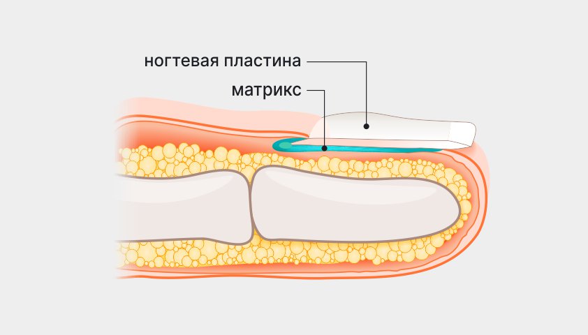 Матрикс