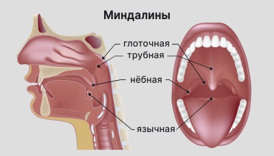 Миндалины3