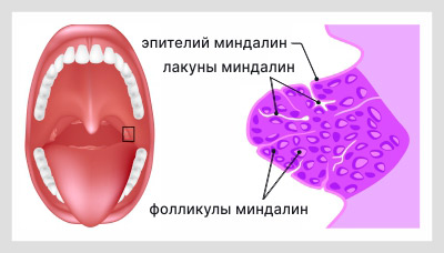 Фолликулярная ангина — симптомы, причины, лечение, мкб 10