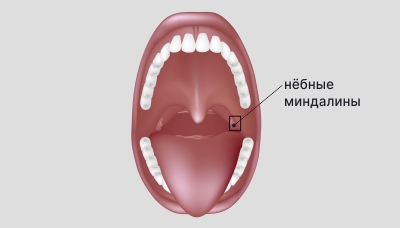 Нёбные-миндалины