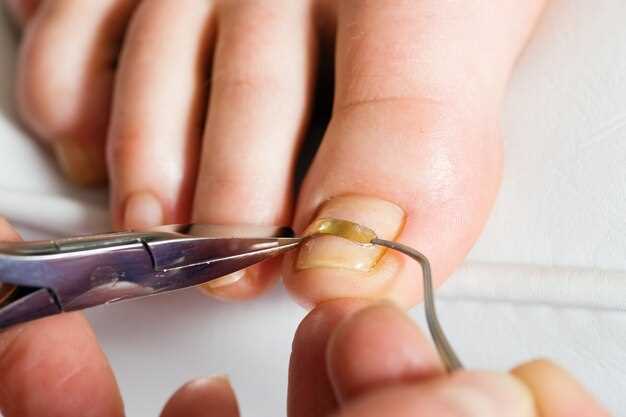 Рекомендации по выбору обуви