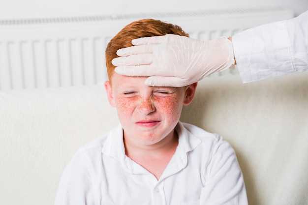 Сколько дней проявляется сыпь при ветрянке