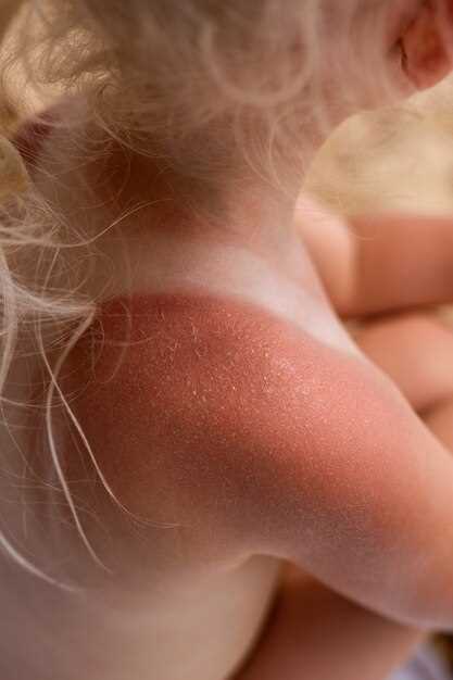 Количество новых высыпаний на разных стадиях заболевания