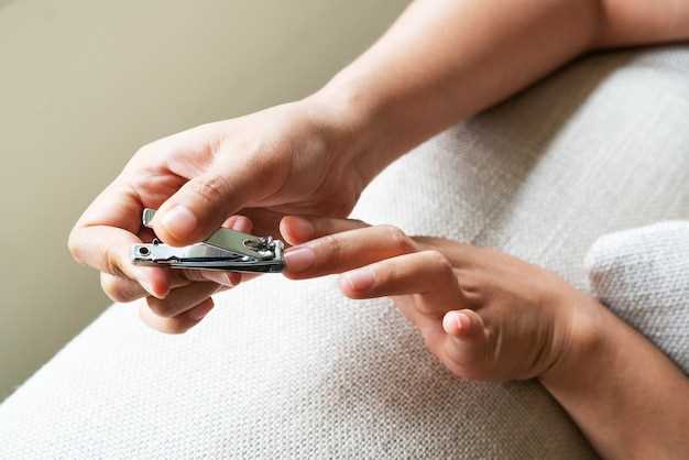 Состояние ногтей на руках и его значение для здоровья