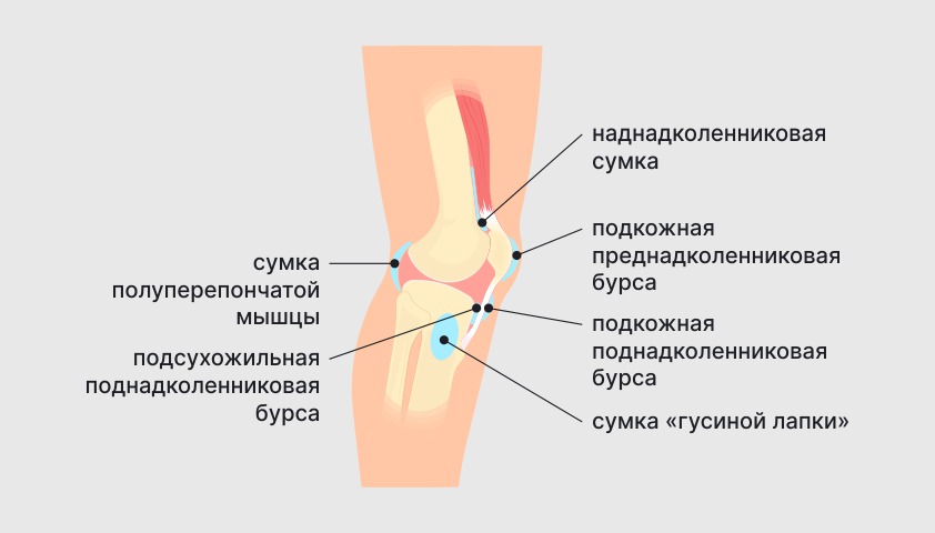 Бурсит коленного сустава — что это, симптомы и лечение